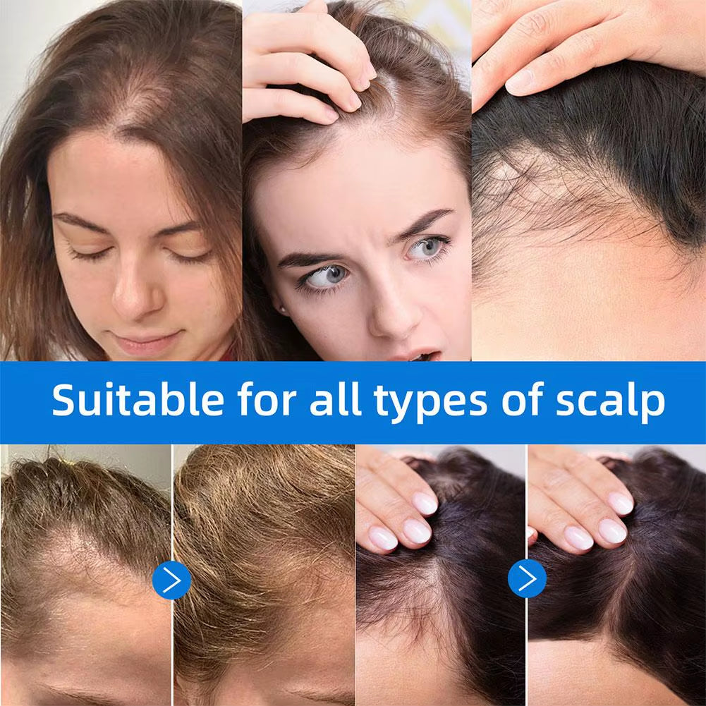 Seapuri Scalphy Hair Essence Rollerball Nourishing Anti-Frizz Hair Serum Refreshing Strengthening Hair Essence Scalp Treatment